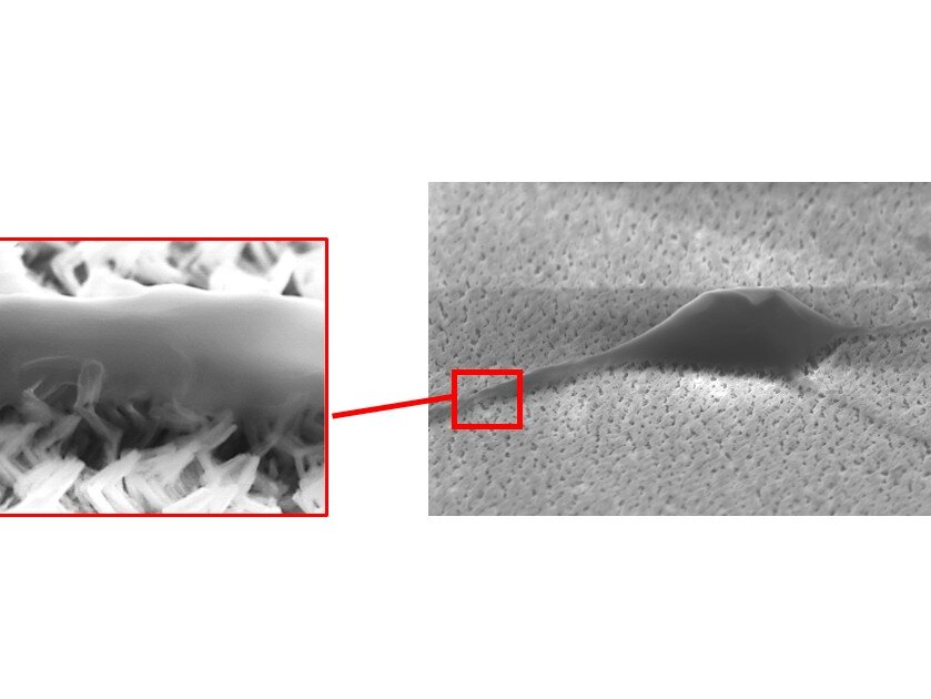 The "physical massage" induces the neural stem cell to differentiate rapidly into the desired neuron. (photograph magnification: 10,000 times)